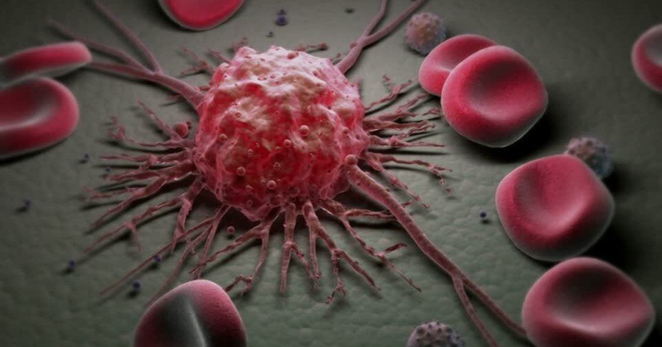 Oncology